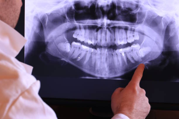 Best Emergency Treatment for Toothache in Farmington, NM